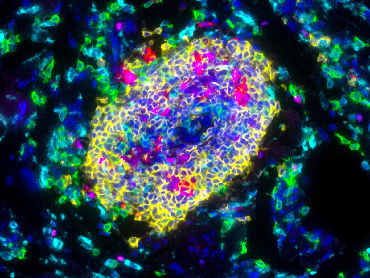 New Scientist. Science news and long reads from expert journalists, covering developments in science, technology, health and the environment on the website and the magazine.