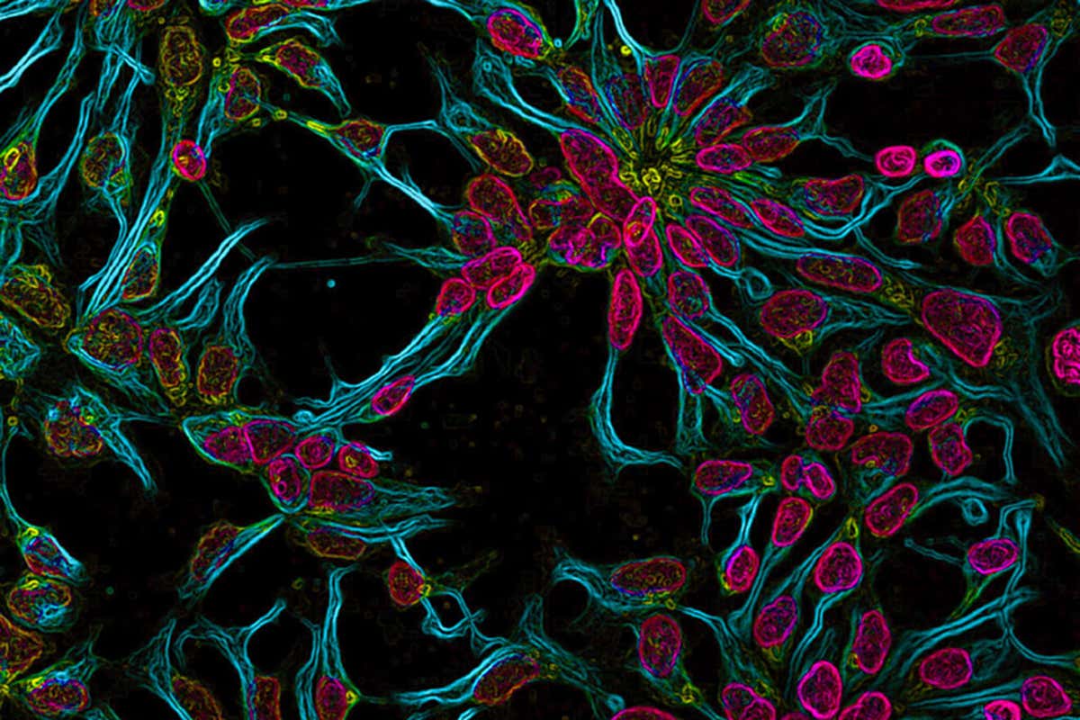 Unexpected beauty of cancer research revealed in competition shortlist