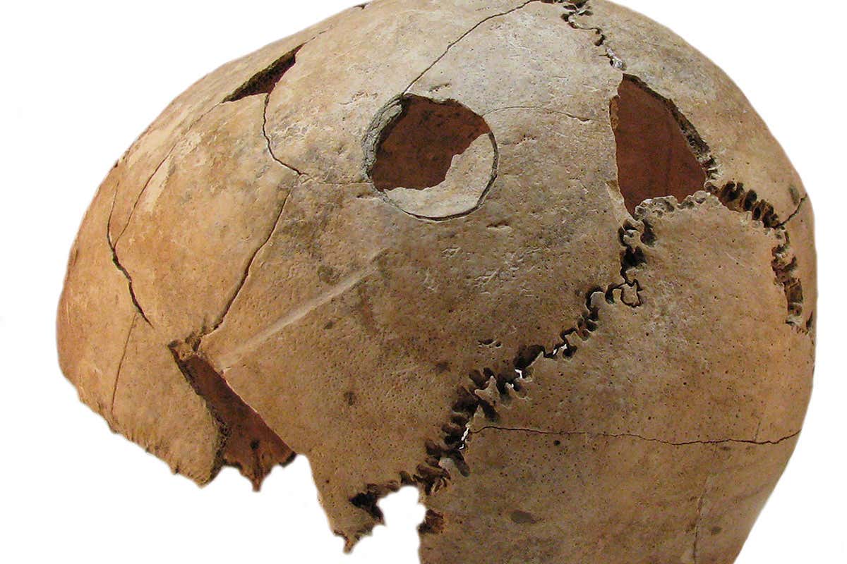 DNA reveals ancient Croatian massacre was an indiscriminate killing