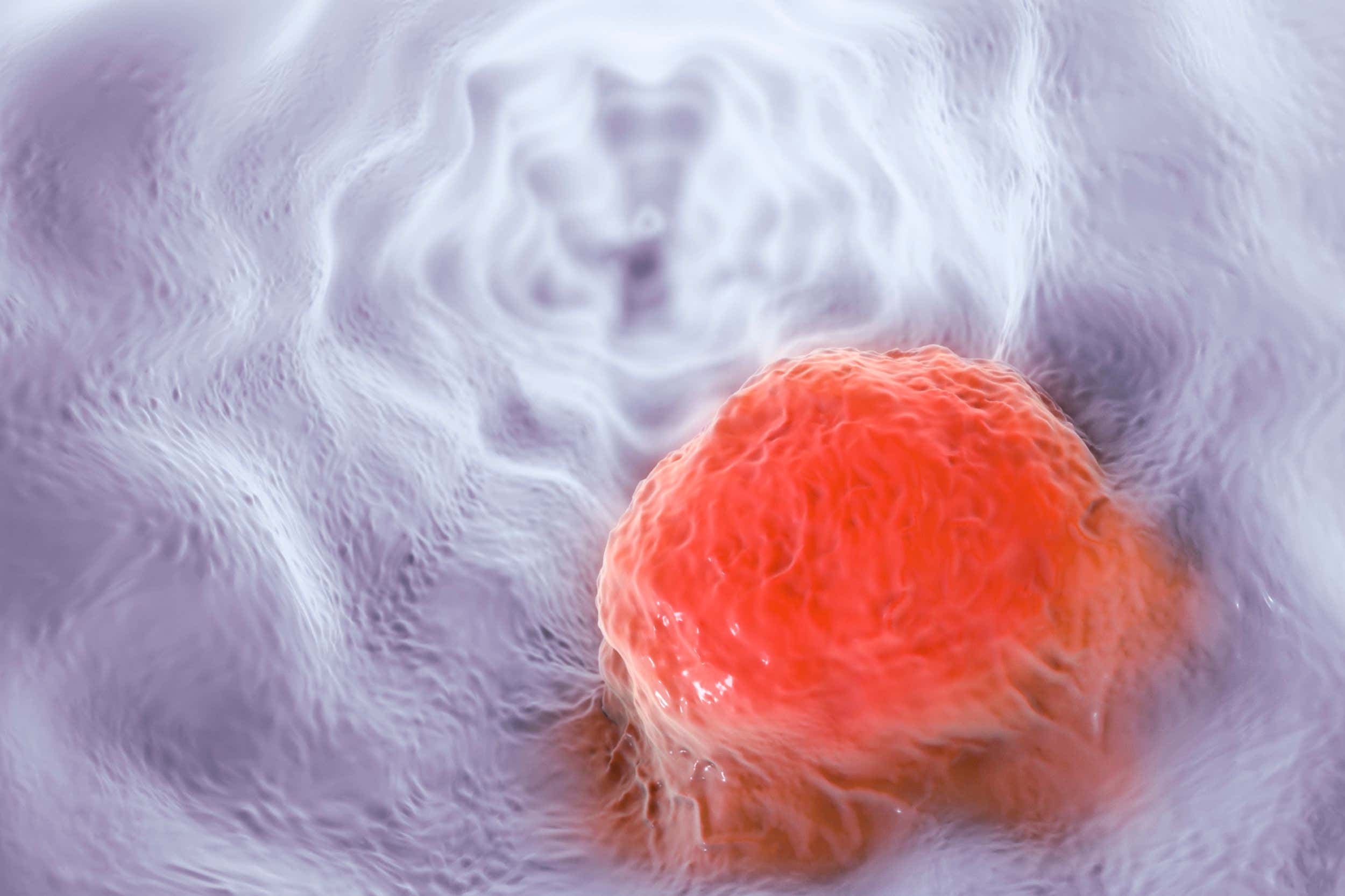 Oesophageal cancer, computer illustration.