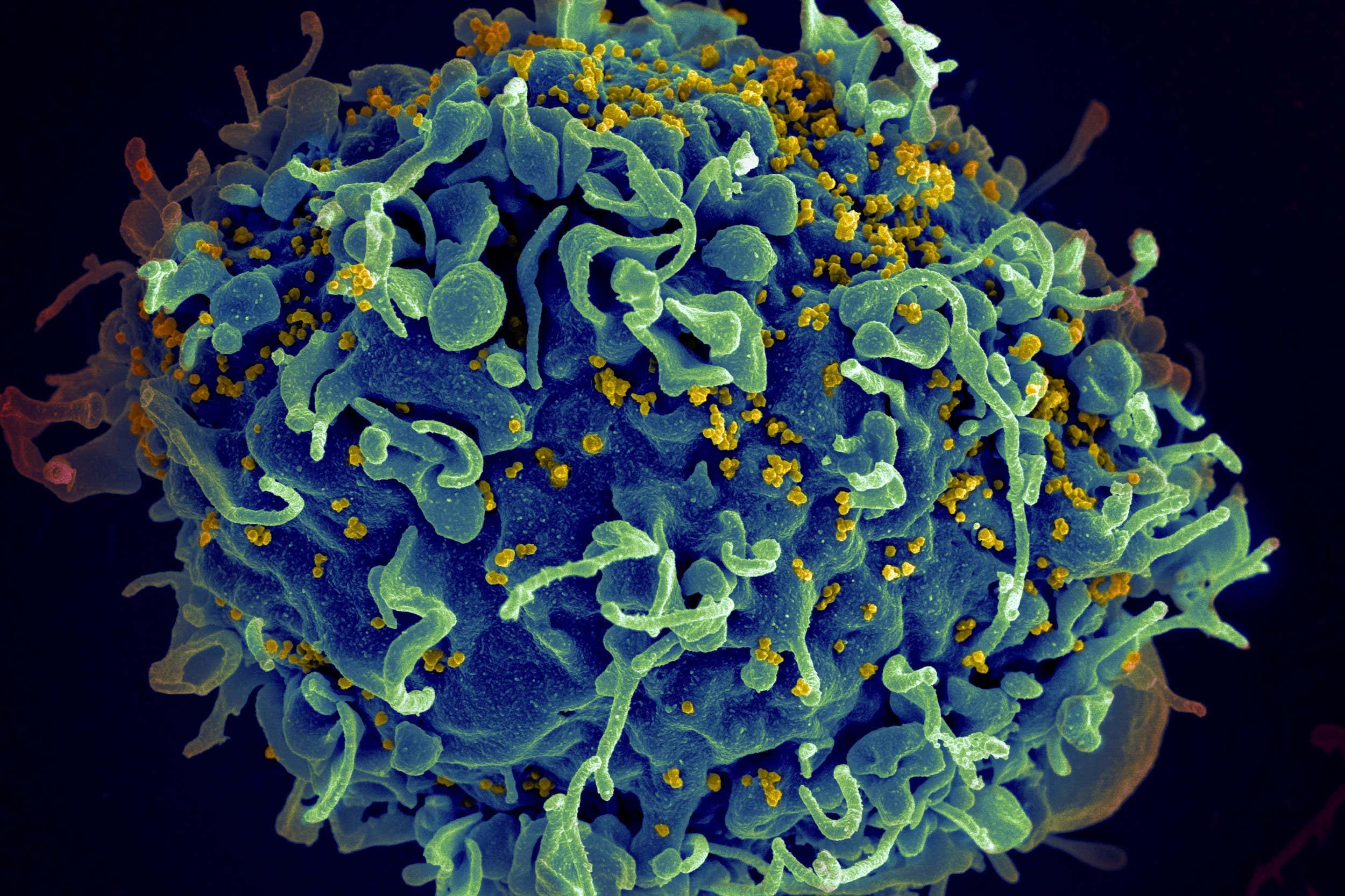 ECF1N3 Scanning electron micrograph of HIV particles infecting a human H9 T cell.