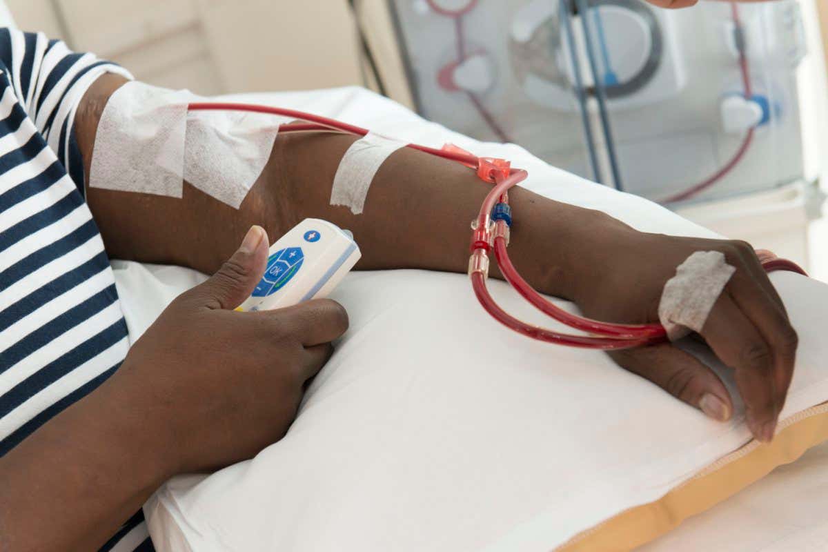 Not to be used for advertising or in a defamatory context MODEL RELEASED. Kidney dialysis patient monitoring herself while in hospital undergoing dialysis for a kidney disorder. The tube (cannula) in her arm is taking blood to and from a dialysis machine. Kidney dialysis (haemodialysis) is used for those with reduced or failing kidney function. A machine is used to remove waste and excess water from the blood, a function normally served by the kidneys. Photographed in the UK.
