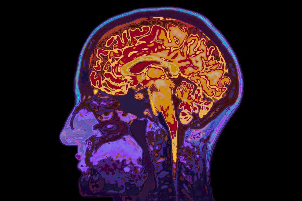 MRI Image Of Head Showing Brain; Shutterstock ID 344282432; purchase_order: -; job: -; client: -; other: -