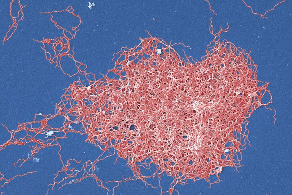 Borrelia burgdorferi bacteria