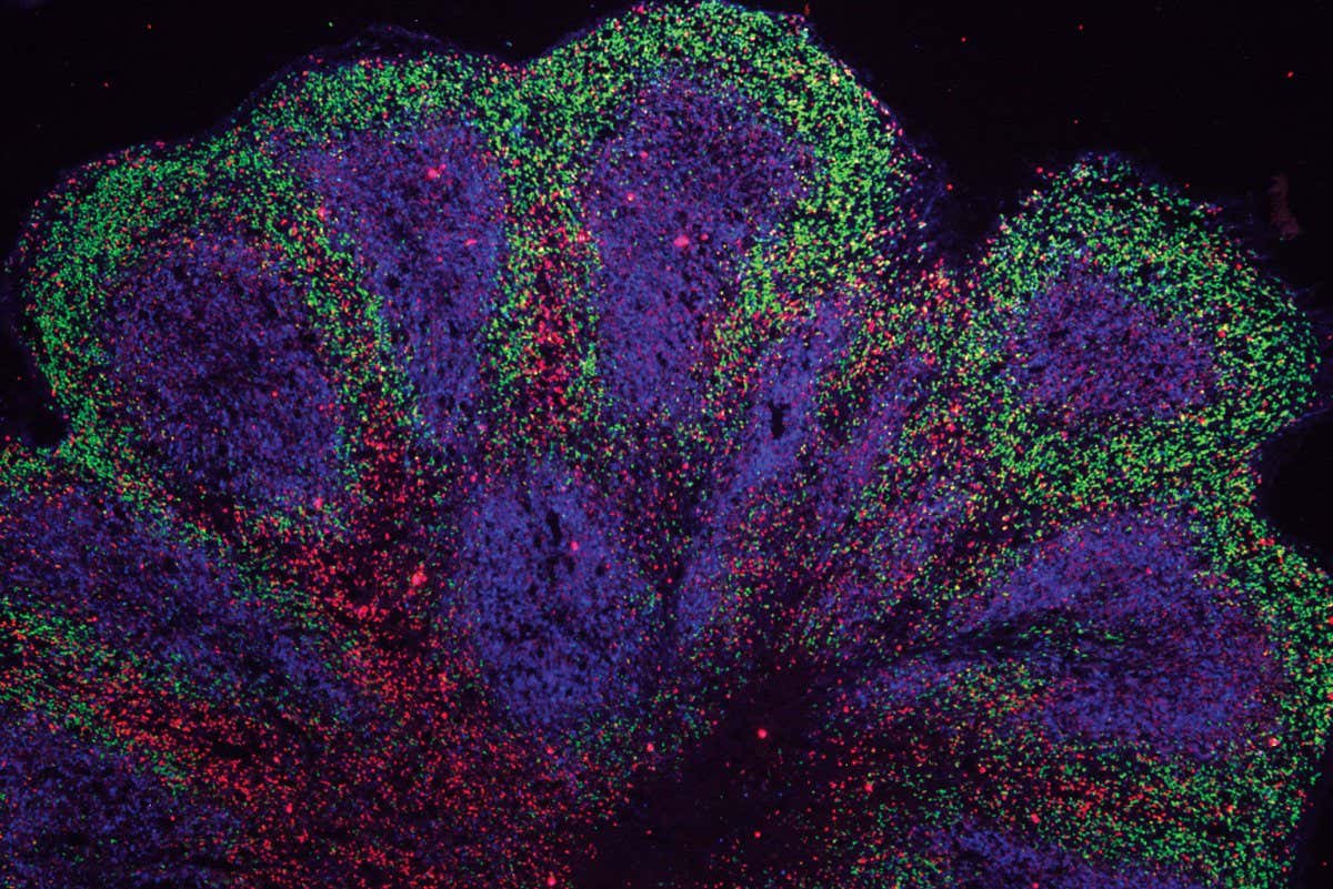 Mini-brain organoids
