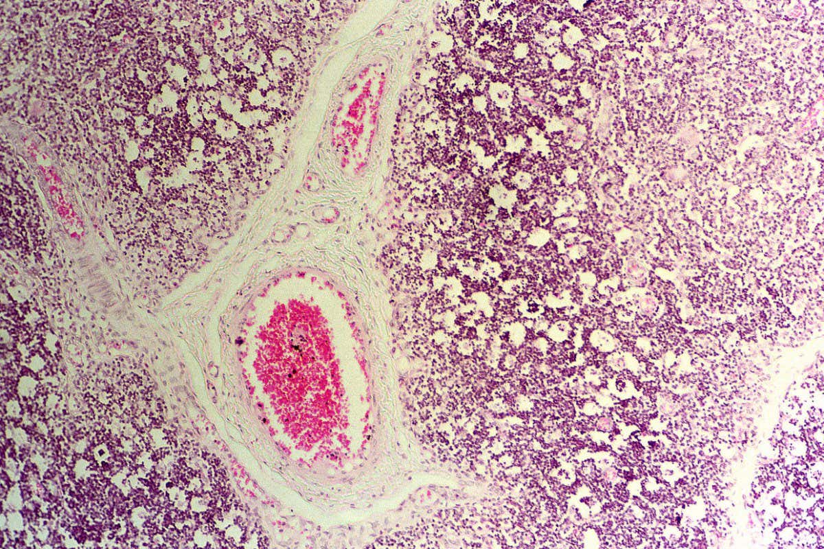 Cells of the thymus, a lymphoid organ