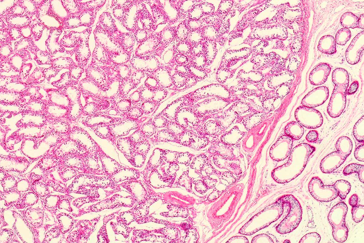 Light micrograph cross section of a normal human testicle or testes. The tunica albuginea is the dense, white inelastic tissue immediately covering the testis. The septa extends from the tunica albuginea into the testicle, dividing the testes into lobules.