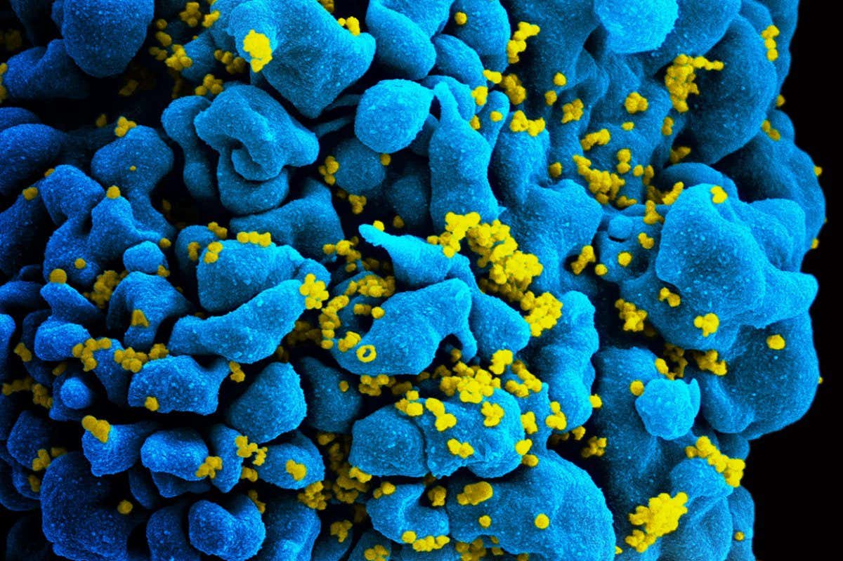 HIV-infected T-cell