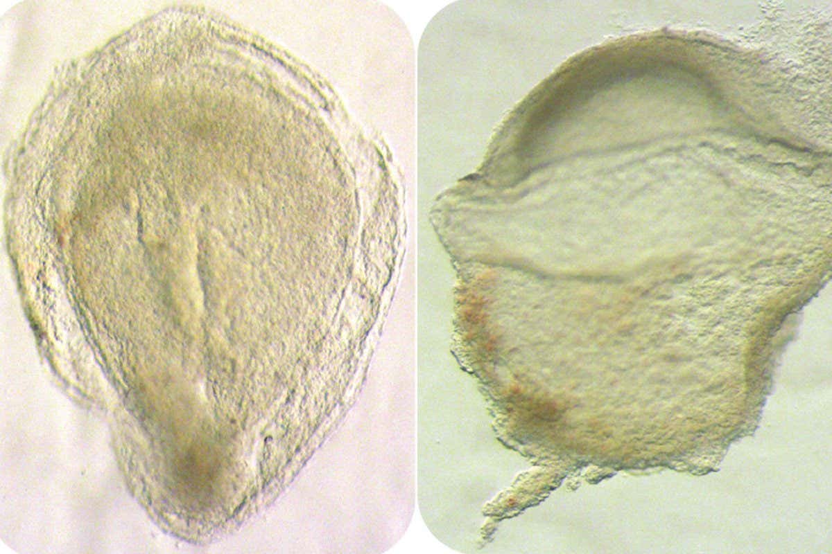 A top (dorsal) view of a day 16-19 human embryo