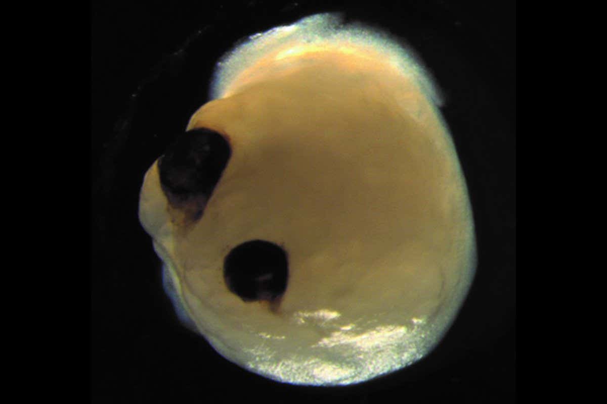 A brain organoid with eye-like optic cups Elke Gabriel