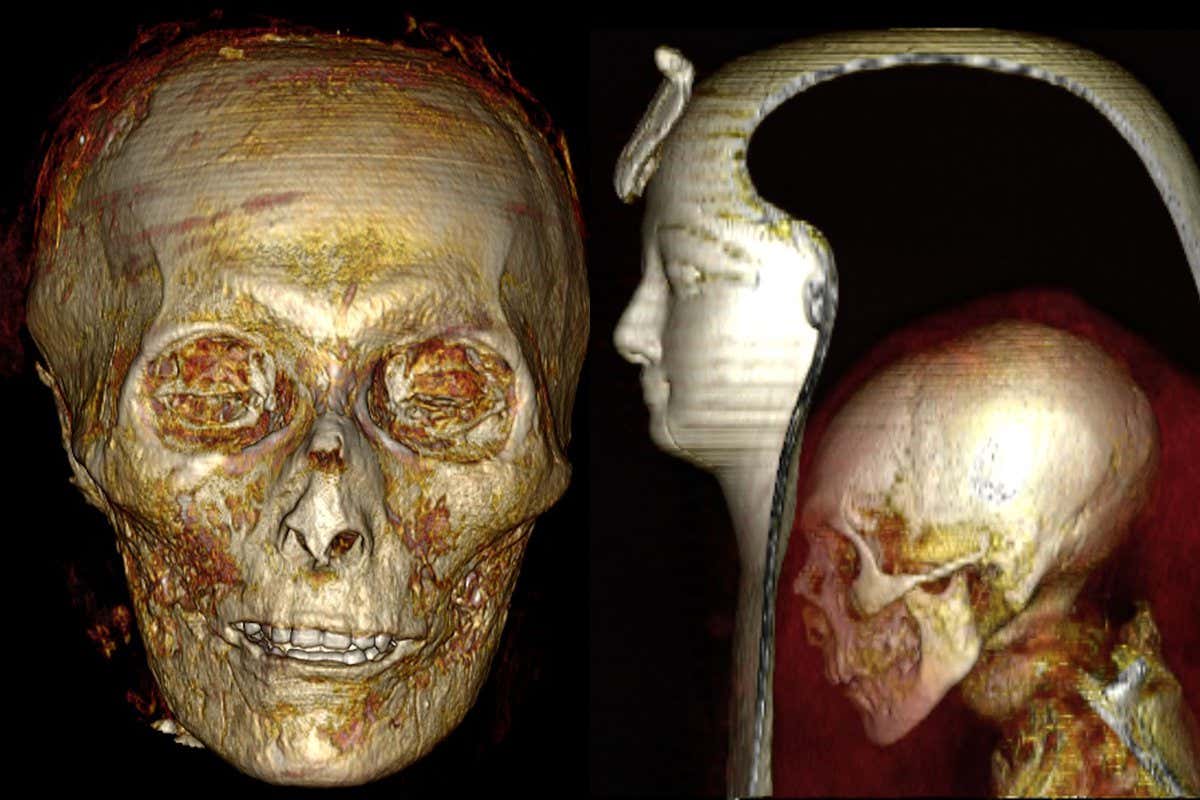 The pharaoh's skull, including his teeth in good condition Right: The pharaoh's mummy
