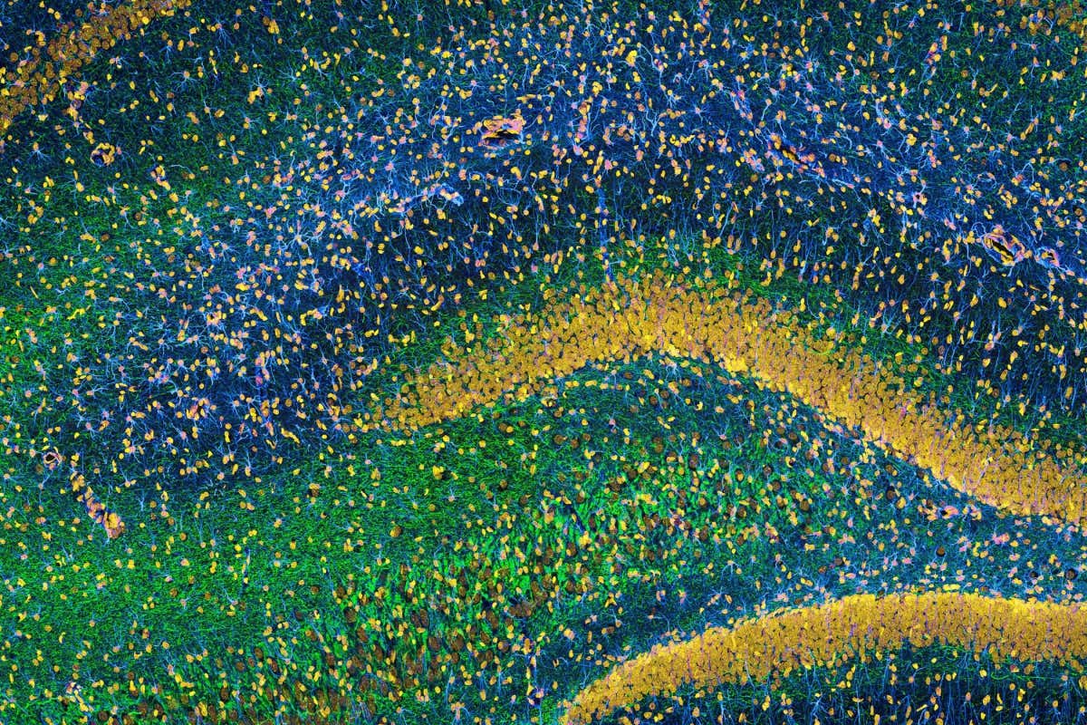 Health Check newsletter: The brain’s amazing adaptability