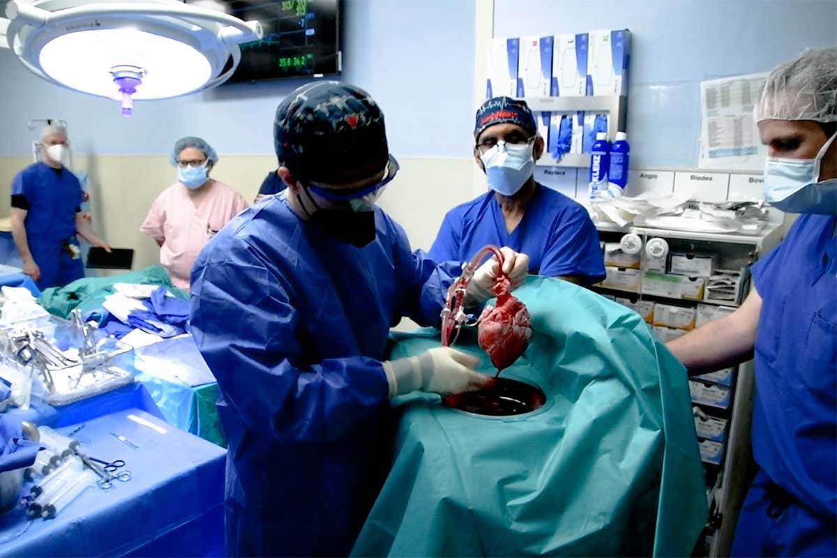 Watch as a pig heart is transplanted into a human for the first time