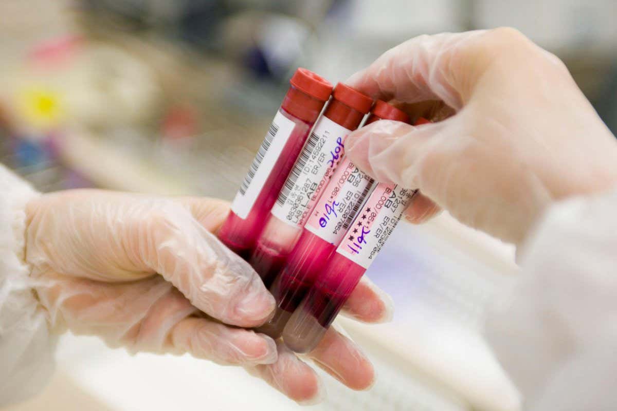 Close-up of blood samples.