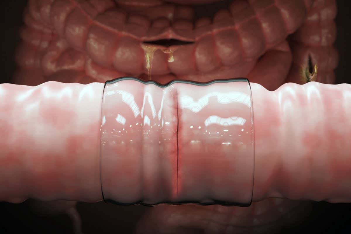 Duct tape inspired bandage