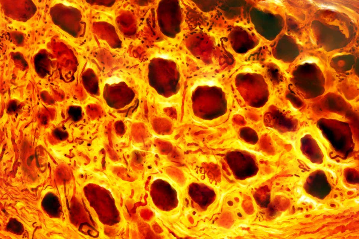 Light micrograph of a dorsal root ganglion stained with Cajal's silver nitrate. Near the rounded cell bodies of the pseudounipolar neurons the axons make several turns, forming Cajal's initial glomeruli.