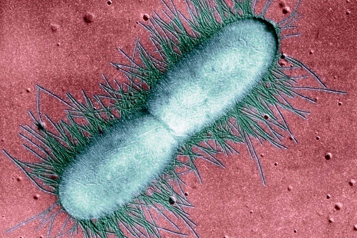 E. coli bacterium. Coloured transmission electron micrograph (TEM) of an Escherichia coli (E. coli) bacterium in the early stages of binary fission, the process by which the bacterium divides. This Gram-negative bacillus (rod-shaped) bacterium normally inhabits the human intestines. Under certain conditions it may undergo rapid division, which increases its numbers to such an extent that it causes infection. E. coli cause 80% of all urinary tract infections, travellers' diarrhoea and gastroenteritis in children. The hair-like appendages around the bacterium are pili, structures used for bacterial conjugation. Magnification: x17,500 at 6x7cm size.