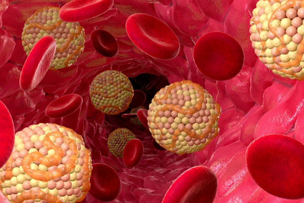 High cholesterol levels. Computer artwork balls of cholesterol in a blood vessel. Cholesterol is a lipid, a fat-like substance. High blood levels of LDL (low-density lipoprotein) cholesterol compared to HDL (high-density lipoprotein) cholesterol are thought to raise the risk of atherosclerosis, the build-up of fatty deposits on artery walls. This is a major cause of heart attack and stroke.