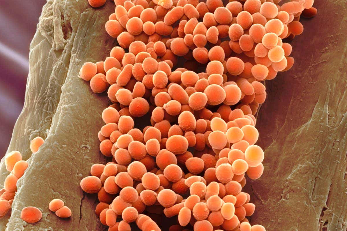 Lactococcus lactis bacteria,coloured scanning electron micrograph (SEM). This lactic acid-producing bacteria is used in the production of cheese and other fermented products. Magnification: x2500 when printed at 10 centimetres wide.