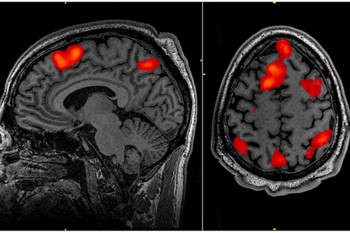 FMRI scan during working memory tasks