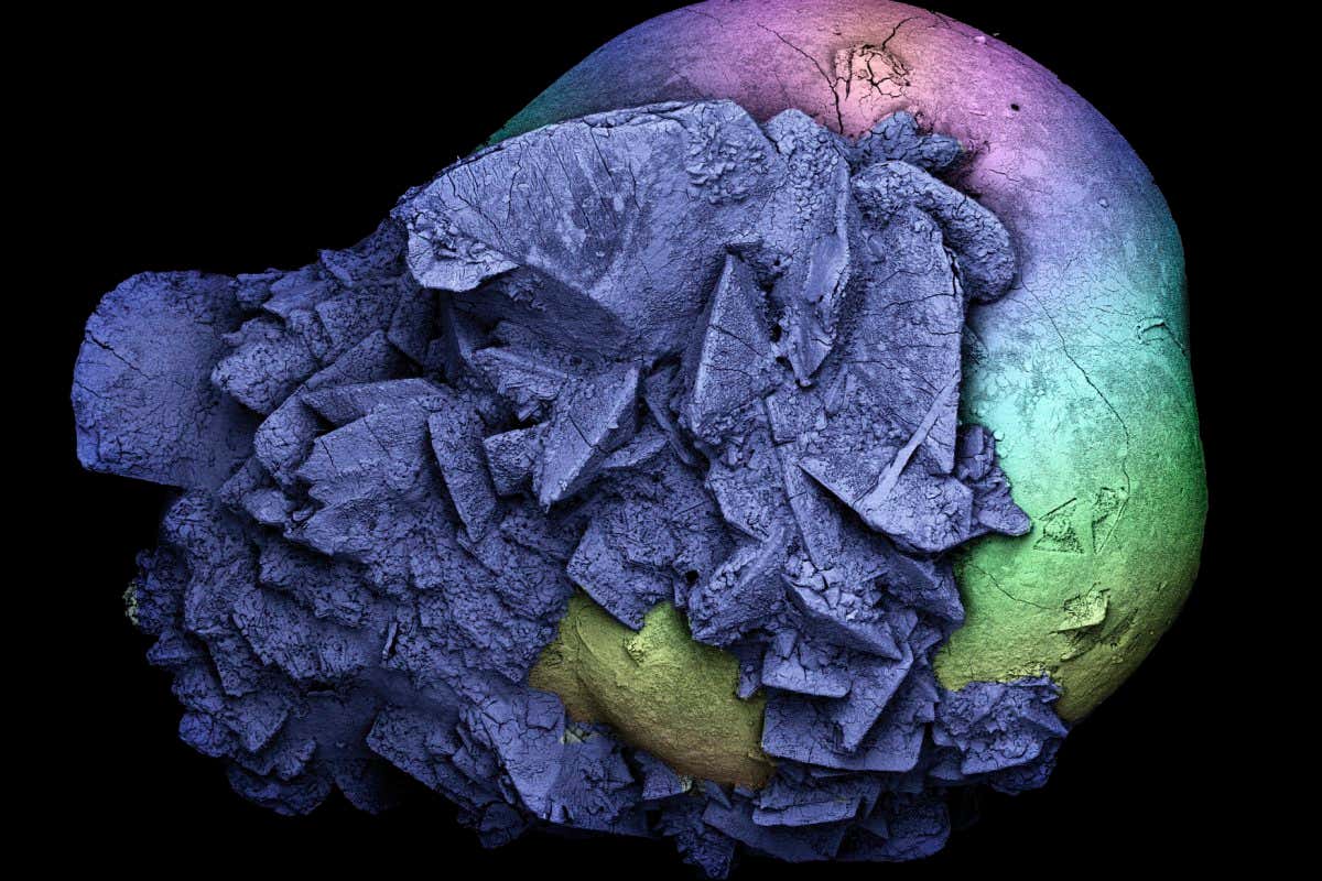 A magnified kidney stone displayed via a coloured scanning electron microscope