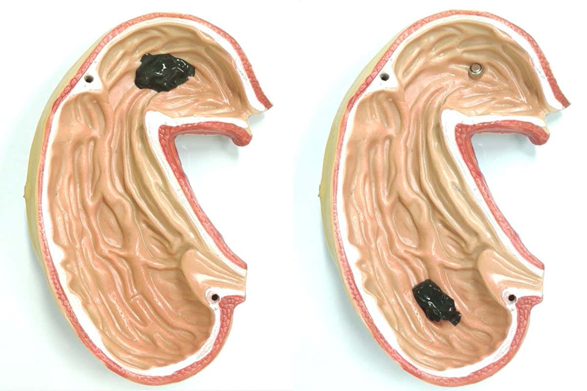 Robot made of magnetic slime could grab objects inside your body