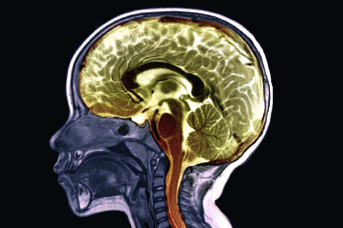 A coloured MRI scan of a healthy two-year-old's brain