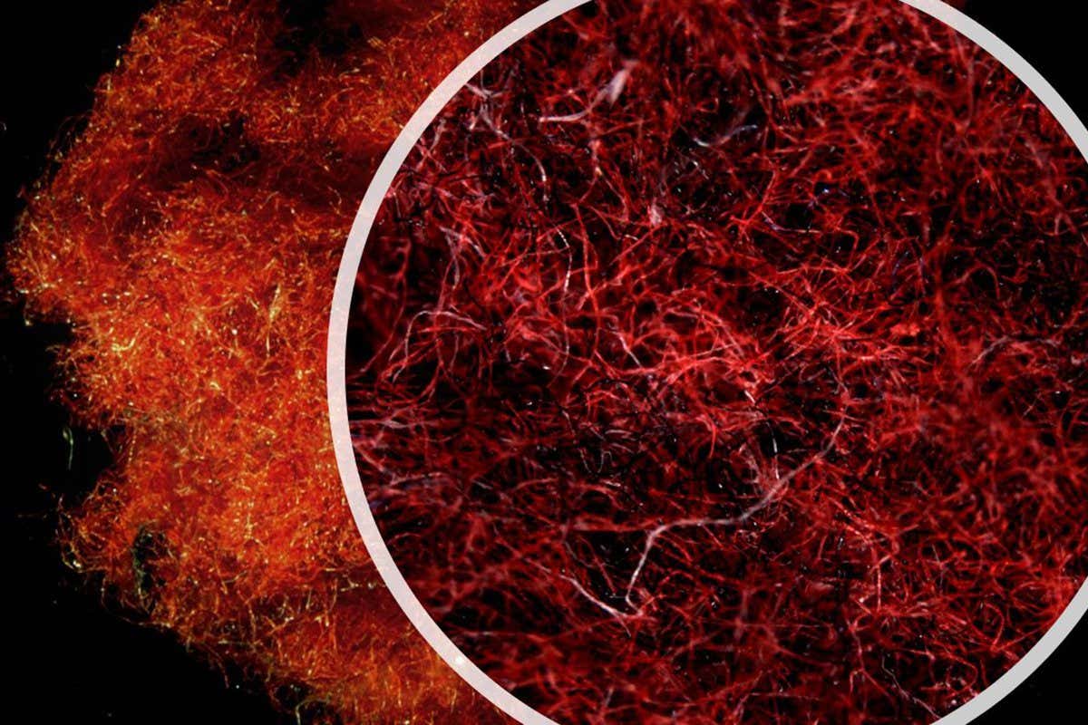 Microscopy of cotton (red) and polyester (black) fibers collected from tumble dryer exhaust. (https://creativecommons.org/licenses/by/4.0/)