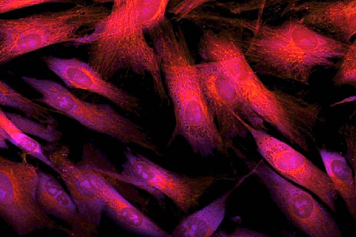 A fluorescence light micrograph of fibroblast cells from human skin