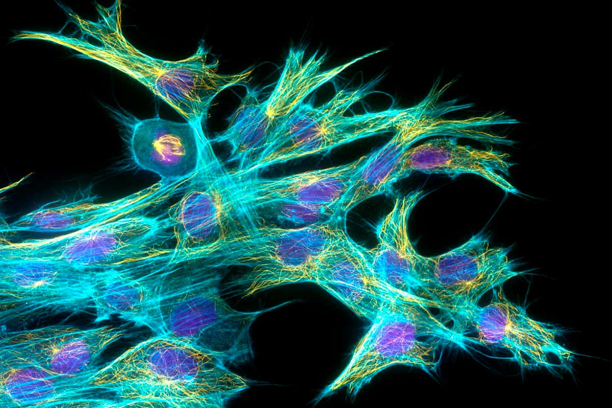 Fibroblast cells. Immunofluorescence light micrograph of fibroblast cells. The cell nuclei are purple, actin filaments are cyan and microtubules, protein filaments that make up part of the cytoskeleton, are yellow. Fibroblasts are cells that give rise to connective tissue such as collagen, the main structural protein in the body. They are important in wound healing. Magnification: x500 when printed at 10 centimetres wide.