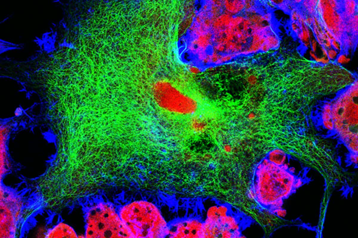 Neuroblastoma cells: nuclei are stained in red, microfilaments are in green and in blue