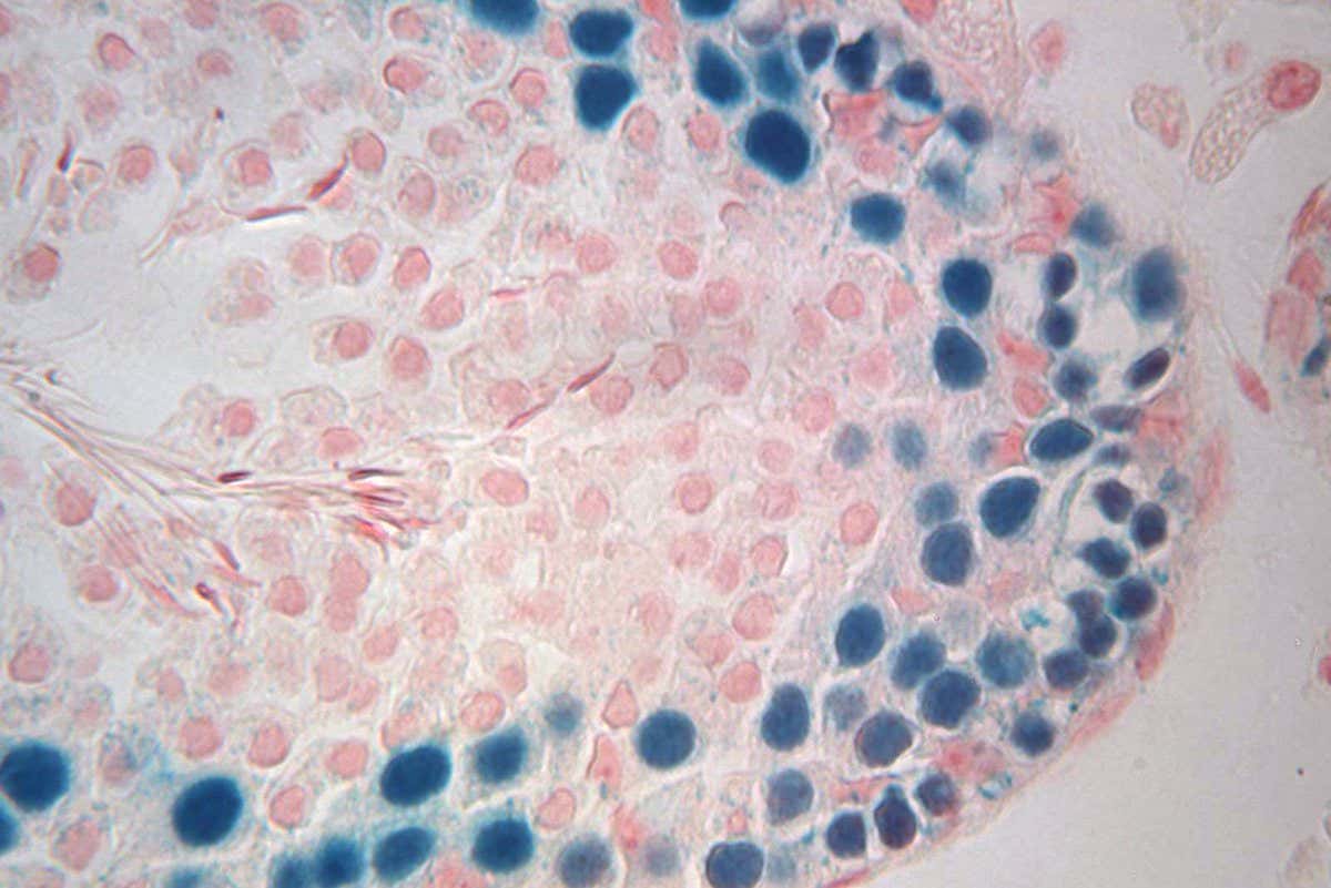Cross section of infertile mouse testis showing previously frozen transplanted rat germ cells and sperm. Frozen testicular tissue still viable after two decades.