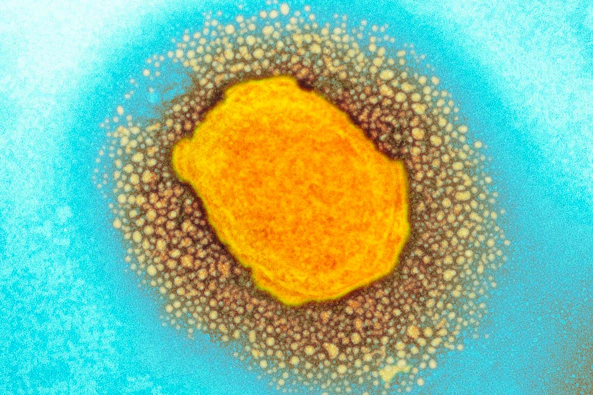 A monkeypox virus particle captured via a coloured transmission electron micrograph