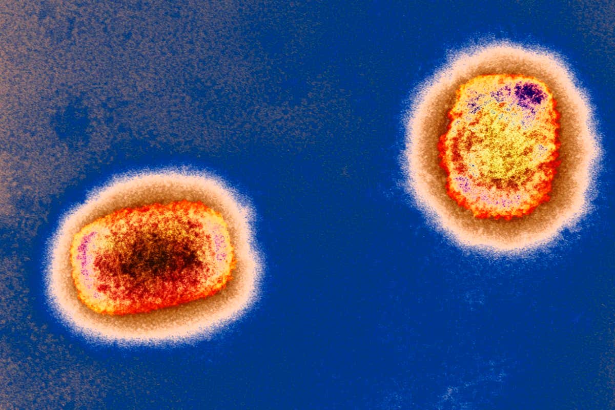 Monkeypox virus particles captured via a coloured transmission electron micrograph