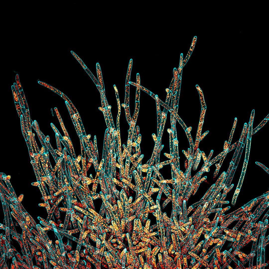 The winning image for the Americas was captured by Ivan Radin (USA). A maximum projection of the deconvolved Z-stack of moss Physcomitrium patens protonemal cells. Cell walls (in cyan) were stained live with calcofluor white. Chloroplasts autofluorescence is in Fall LUT.