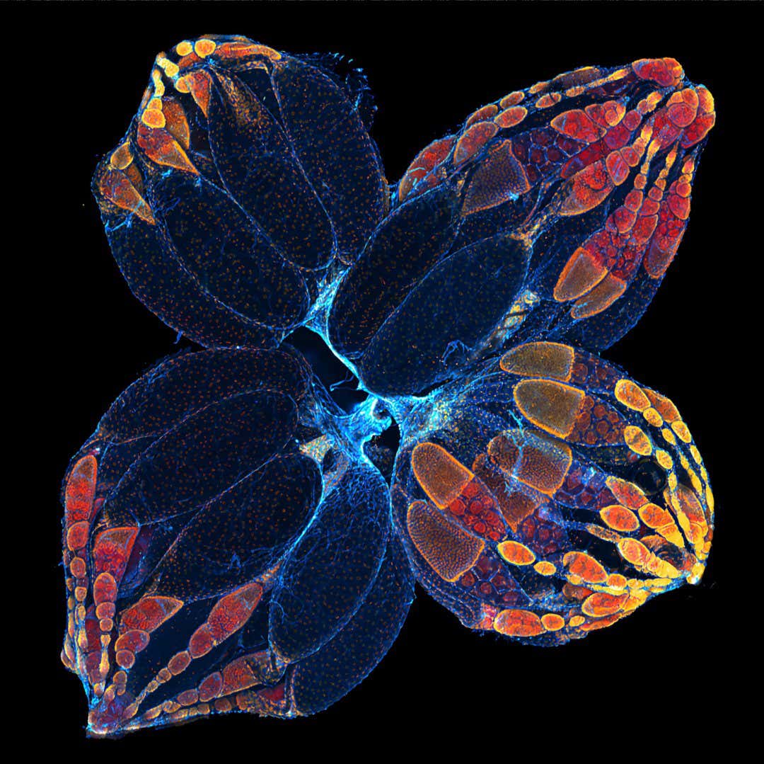 Ovaries of the fruit fly. Yujun Chen (USA) Honorable mention ? Yujun Chen (USA)