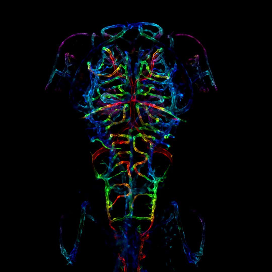The developing nervous system of an embryonic zebrafish. Specifically, the image is a color-coded projection of the axonal projections of a zebrafish fixed six days after fertilization. LayraCintron-Rivera (USA) Honorable mention ? LayraCintron-Rivera (USA)