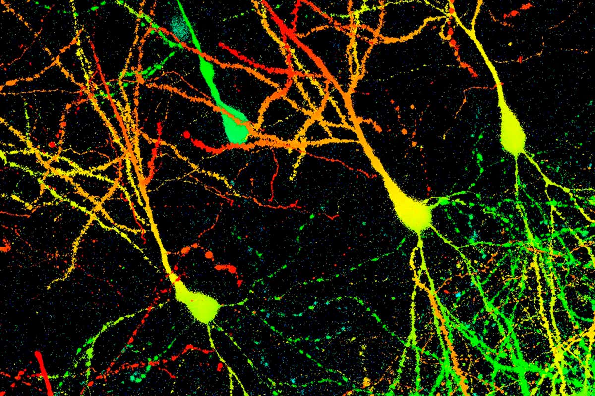 Mouse brain neurons