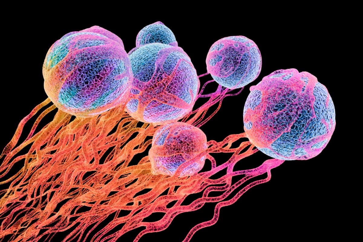 Cancer cells. Computer illustration of cancer cells, showing the blood vessel formation providing the cells with oxygens and nutrients. The cells with their nuclei are shown in blue.