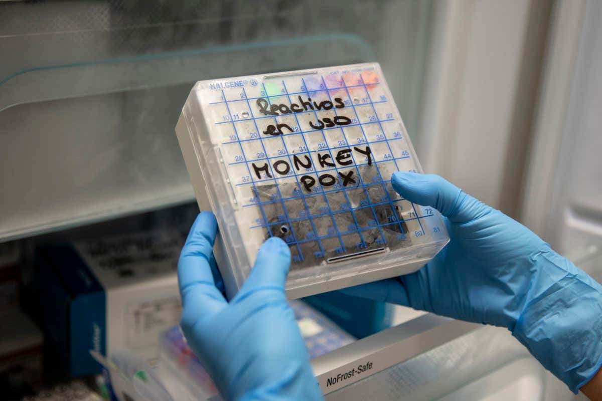 A medical laboratory technician prepares to test suspected monkeypox samples at the microbiology laboratory of La Paz Hospital in Madrid, Spain on 6 June
