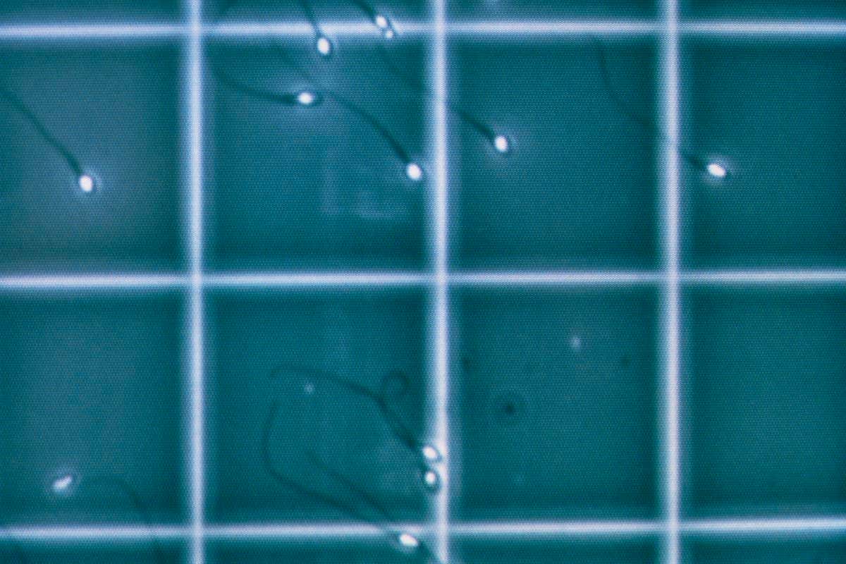 A sperm sample with low numbers of sperm