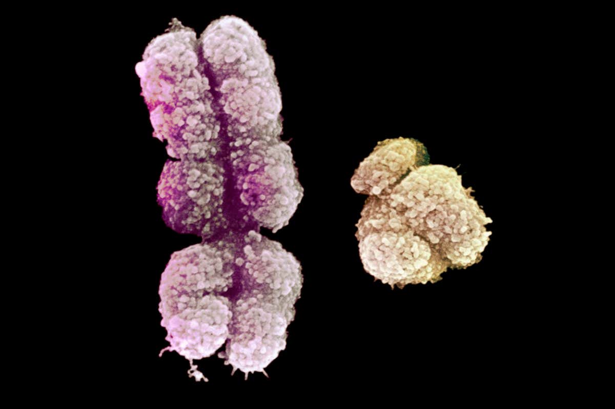 X and Y chromosome