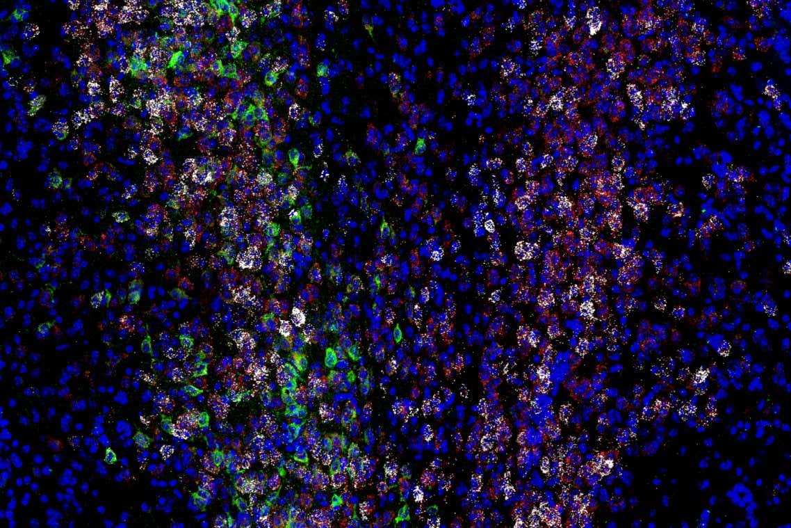 The expression of various genes and proteins (white, red and green) in neurons among mouse brain cells (blue)