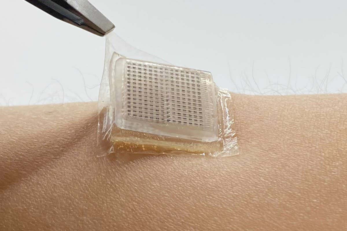 Detaching the bioadhesive ultrasound device from the skin