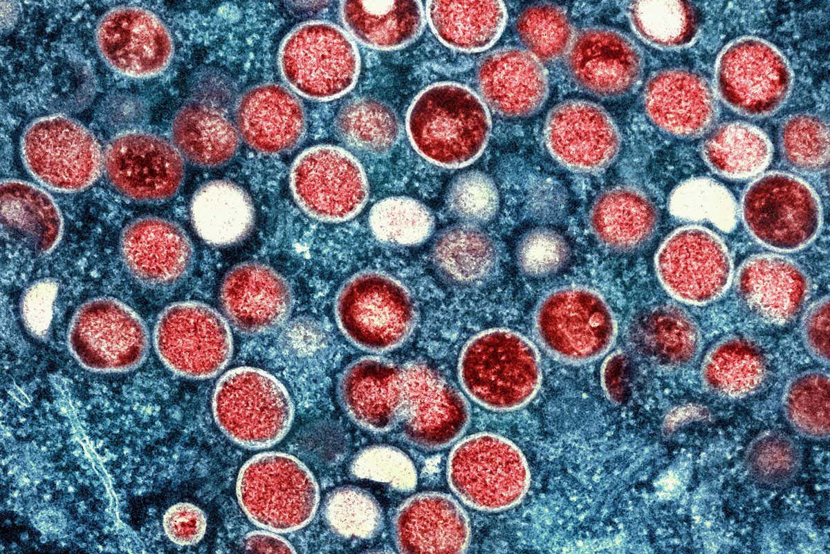 UMD Dental 08/20/10 10:39 6500 7.0 80.0 Imaging #10-041-21 #0882 Necropsy PBMC's Colorized transmission electron micrograph of monkeypox particles (red) found within an infected cell (blue), cultured in the laboratory. Image captured and color-enhanced at the NIAID Integrated Research Facility (IRF) in Fort Detrick, Maryland. C -757.99464 -316.911008 0.07 XpixCal=685.711 YpixCal=685.711 Unit=micron ##fv3