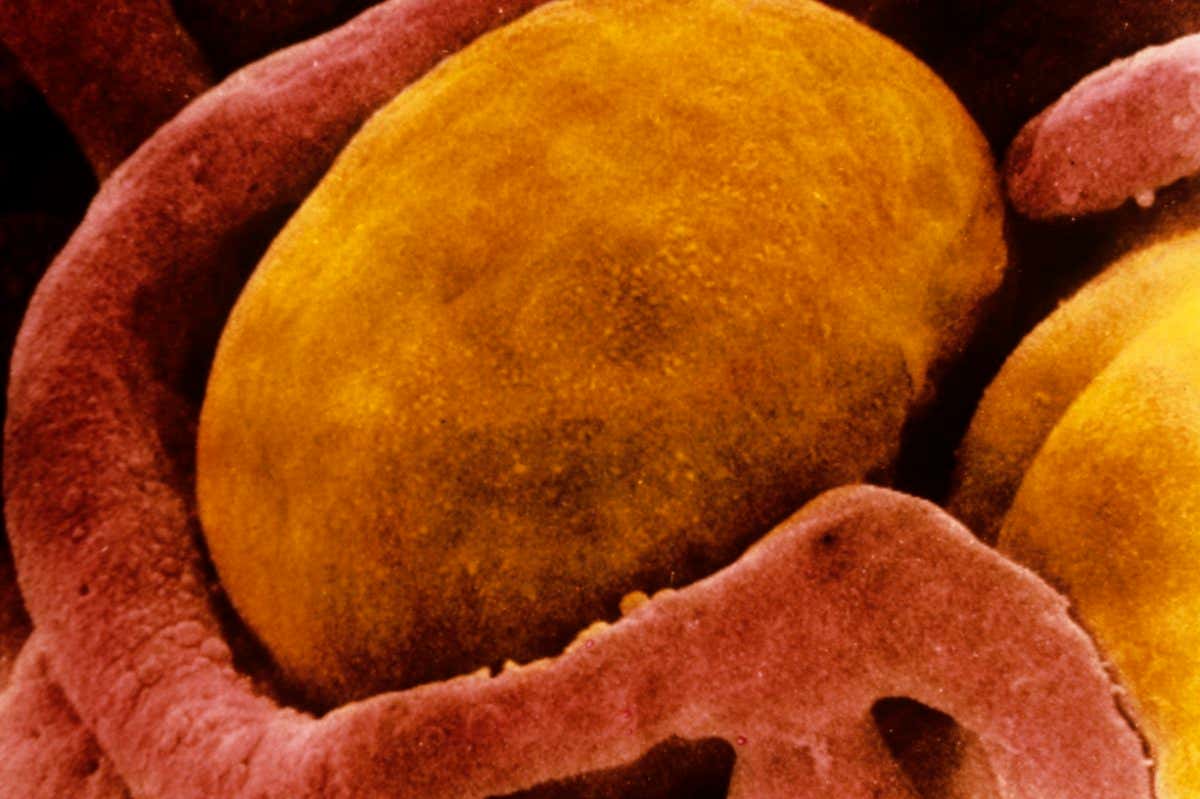 A brown fat cell, surrounded by capillaries, captured via a coloured scanning electron micrograph. Activating brown fat via cold exposure may cause them to burn glucose, which cancerous tumour cells rely on for growth