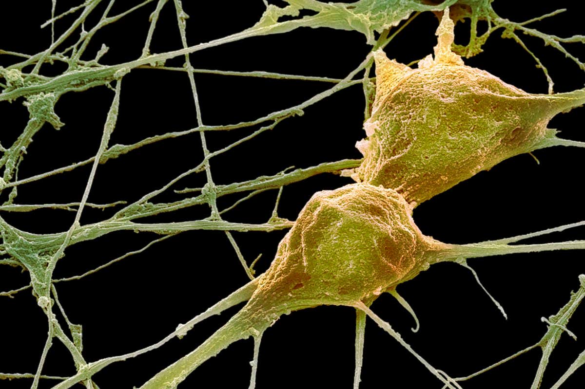 Biological robots grown from human tracheal cells induced neuron healing in a laboratory experiment