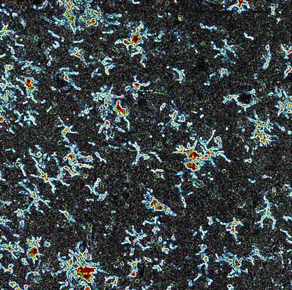 Alzheimer's Society research - immune cells may be involved in Alzheimer's disease. Microglia act as our immune defense in the brain. They're really important to keeping the brain healthy, but Dr Zeinab Abidi, UCL, explores the potentially darker side to microglia - they might be involved in early steps of Alzheimer's disease and are therefore a target for treatments. Pictured here in donated brain tissue from someone with Alzheimer's disease, the repetition and uniformity of the microglia brings up images of patterned carpets seen on the Tube rather than immune cells in the brain. Copyright: Dr Zeinab Abdi, University College London.