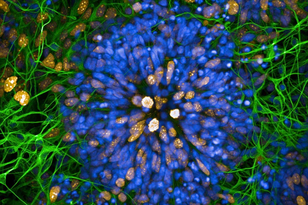 FEATURE IMAGE - Alzheimer's Society research - brain stem cells. Researchers like Dr Charlie Arber use stem cells - cells which don't have a?special function yet - to grow human brain cells in a dish. This can help to understand how dementia starts. This flower-like picture shows a neural rosette - a group of cells which are half way to becoming a brain cells. The green strands are cells turning into brain cells around the edges of the rosette. Copyright: Dr Charlie Arber, UCL.