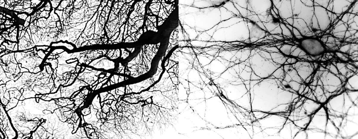 Alzheimer's Society research - Malfunctioning proteins look like branches. When Kirsten Williamson looks up through the trees towards the sky, she thinks of how small we are in the universe. The picture on the left was taken looking up within The Dark Hedges in Northern Ireland, and the right taken down the microscope, looking at cells too small to conceptualise - allowing us to marvel at the wonders of the universe, both big and small. The right image shows a beautiful network of extensions of tau - a type of protein which malfunctions in Alzheimer's disease - which look very similar to the tree branches on the left. These images remind Kirsten of the beauty of neuroscience and being part of a community of scientists trying to understand the brain and how it can cause such devastating diseases. Copyright: Kirsten Williamson, University of Southampton.